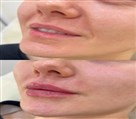 کلینیک زیبایی دکتر خاطره مختاری نیا - تصویر 143291