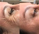 کلینیک زیبایی دکتر خاطره مختاری نیا - تصویر 143297