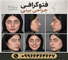 144054