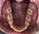 فتوگرافی پزشکی تکرنگ طب - تصویر 144493
