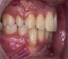 فتوگرافی پزشکی تکرنگ طب - تصویر 144497