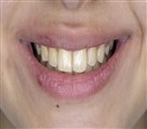 فتوگرافی پزشکی تکرنگ طب - تصویر 144499